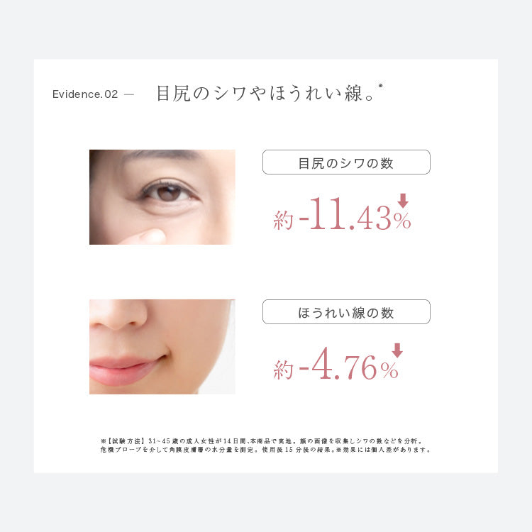 Espelia エスペリア - 超音波美顔器